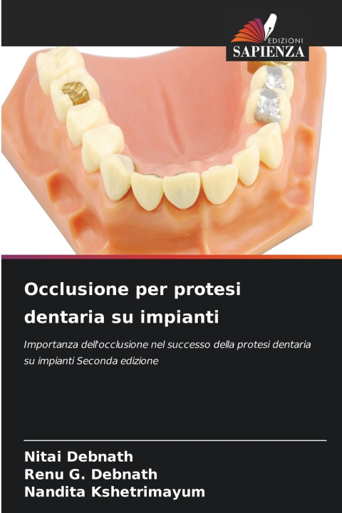 Knjiga Occlusione per protesi dentaria su impianti Nitai Debnath