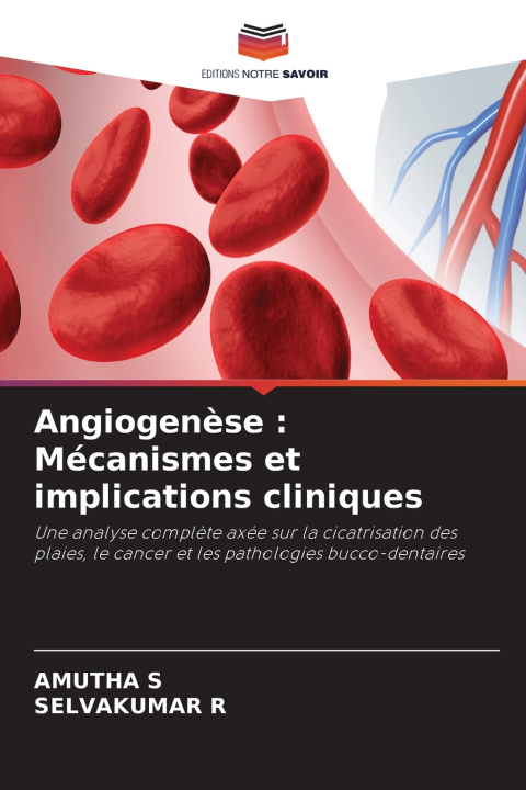 Carte Angiogenèse AMUTHA S