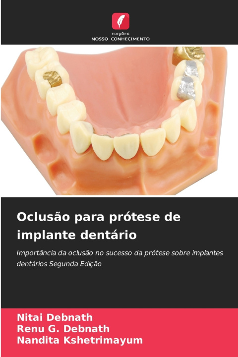 Libro Oclusão para prótese de implante dentário Nitai Debnath