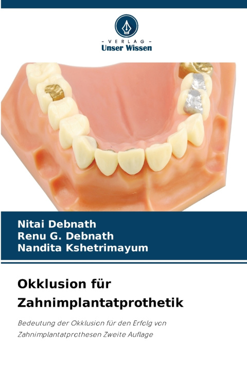 Libro Okklusion für Zahnimplantatprothetik Nitai Debnath