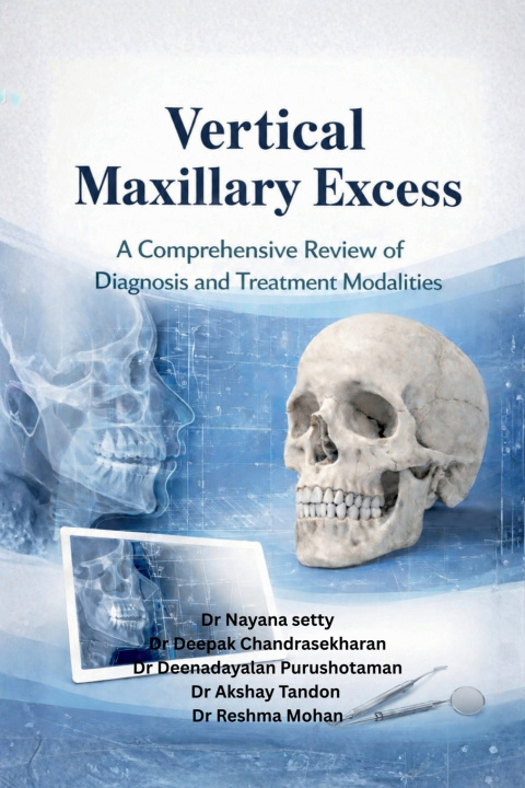 Книга Vertical maxillary excess Dr Nayana setty