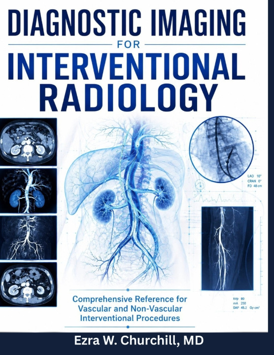 Buch Diagnostic Imaging for Interventional Radiology Dr. Ezra W. Churchill