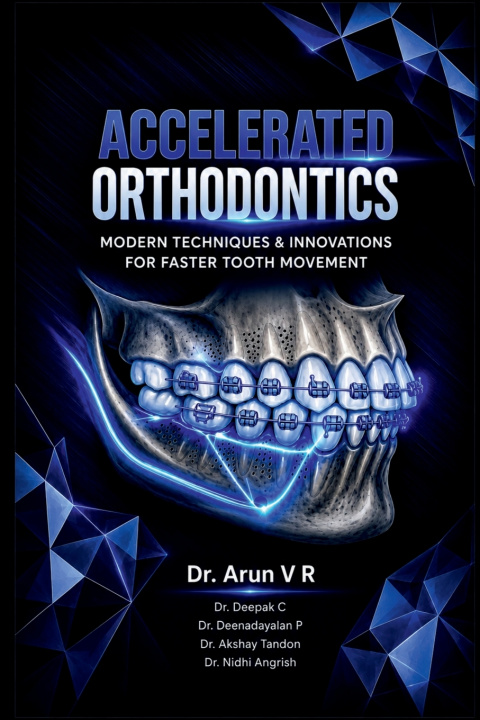 Книга ACCELERATED ORTHODONTICS Dr. ARUN V R