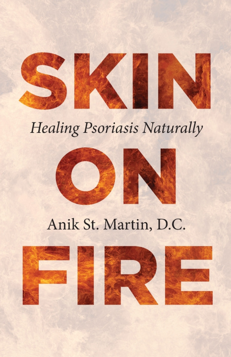 Carte Skin on Fire Anik St. Martin