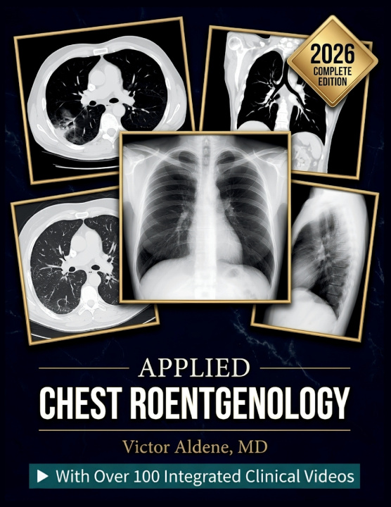 Carte APPLIED CHEST ROENTGENOLOGY Victor Aldene MD
