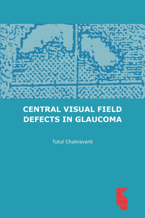 Buch Central Visual Field Defects in Glaucoma Tutul Chakravarti