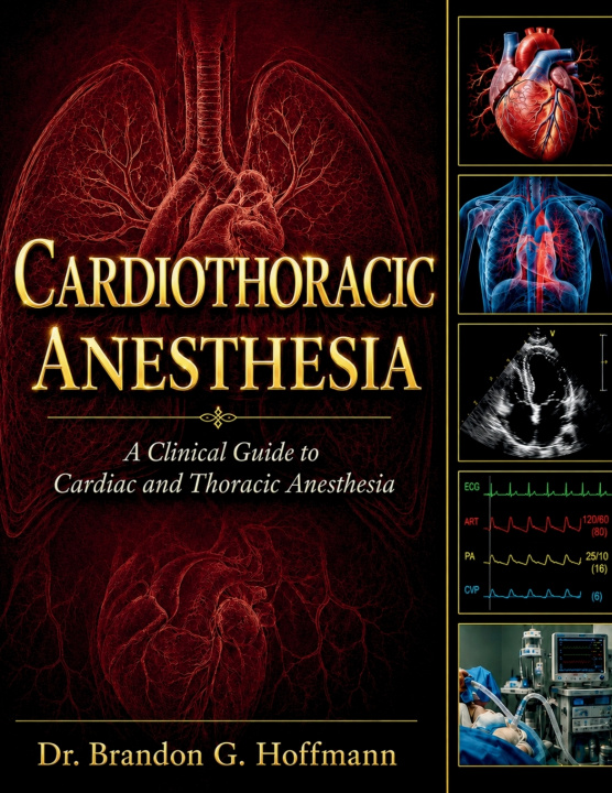 Kniha Cardiothoracic Anesthesia Brandon G. Hoffmann