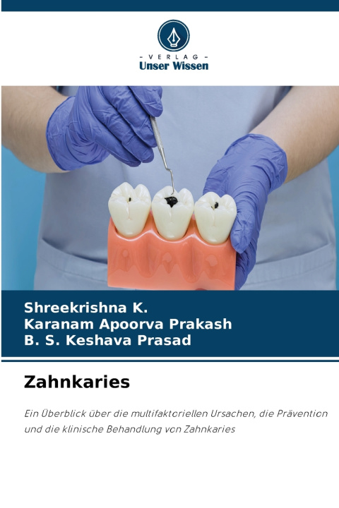 Książka Zahnkaries Shreekrishna K.