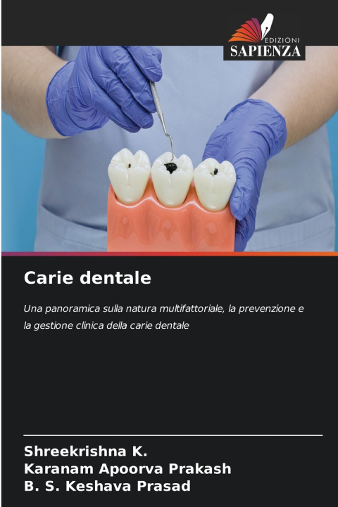 Libro Carie dentale Shreekrishna K.