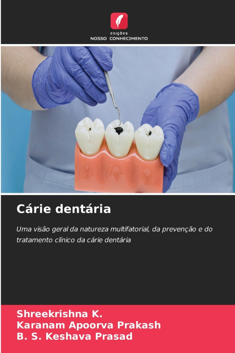 Libro Cárie dentária Shreekrishna K.