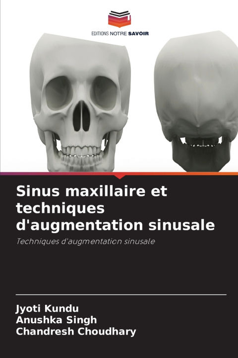 Buch Sinus maxillaire et techniques d'augmentation sinusale Jyoti Kundu