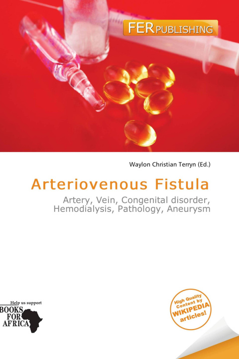 Könyv Arteriovenous Fistula 