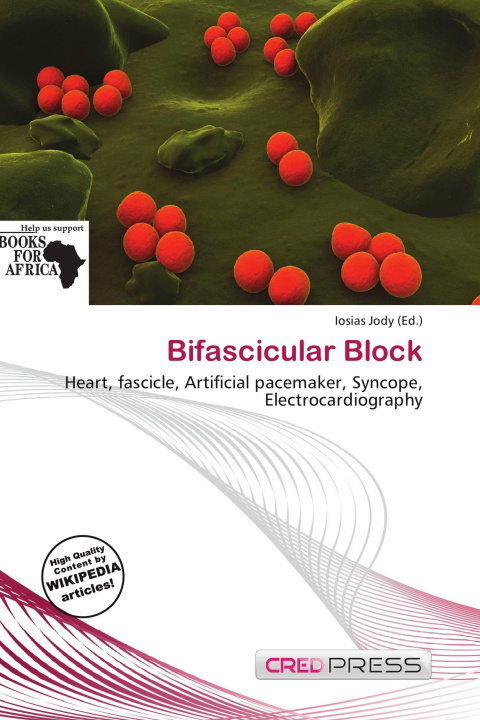 Kniha Bifascicular Block 