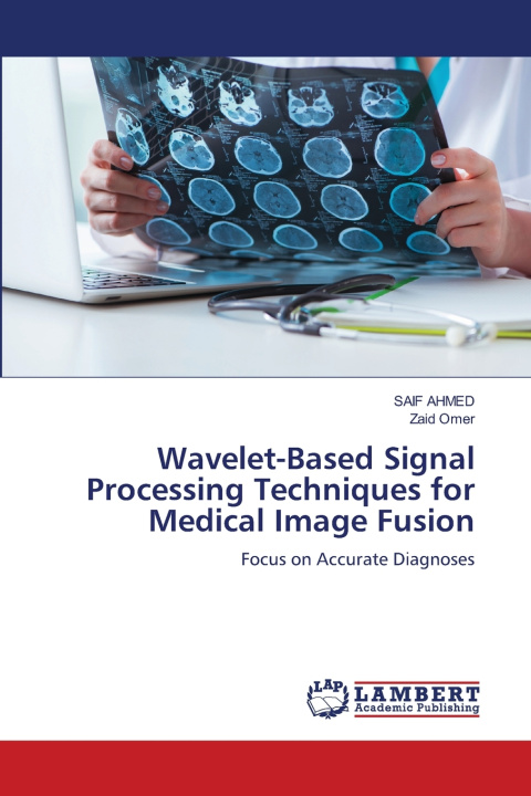 Carte Wavelet-Based Signal Processing Techniques for Medical Image Fusion SAIF AHMED