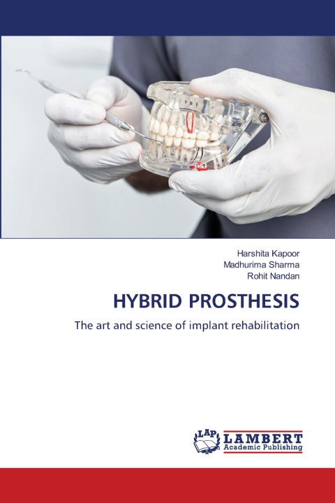 Книга HYBRID PROSTHESIS Harshita Kapoor