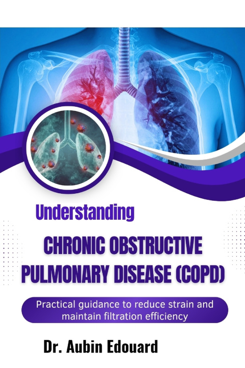 Książka Understanding Chronic Obstructive Pulmonary Disease (Copd) Dr. Aubin Edouard