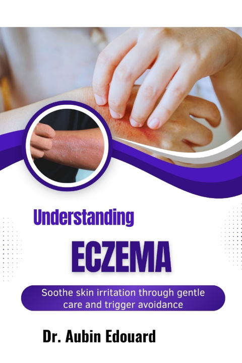 Книга Understanding Eczema Dr. Aubin Edouard