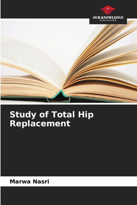 Könyv Study of Total Hip Replacement Marwa Nasri