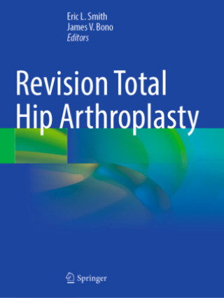 Книга Revision Total Hip Arthroplasty Eric L. Smith