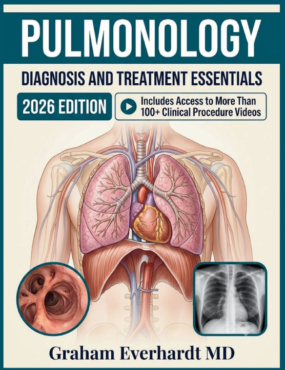 Boek PULMONOLOGY DIAGNOSIS AND TREATMENT ESSENTIALS Graham Everhardt MD