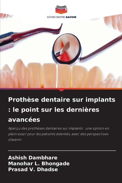 Könyv Prothèse dentaire sur implants Ashish Dambhare