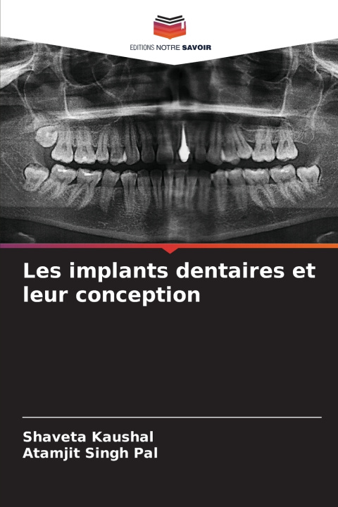 Könyv Les implants dentaires et leur conception Shaveta Kaushal