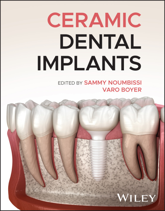 Carte Ceramic Dental Implants Varo Boyer