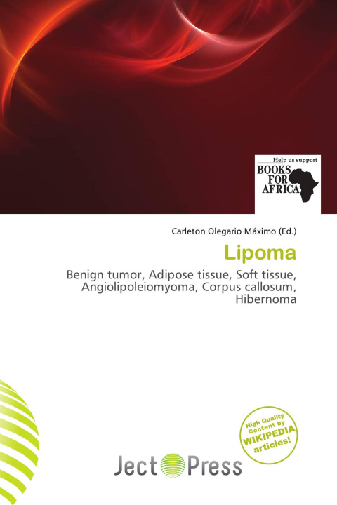 Книга Lipoma 