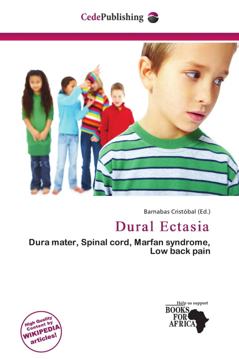Kniha Dural Ectasia 