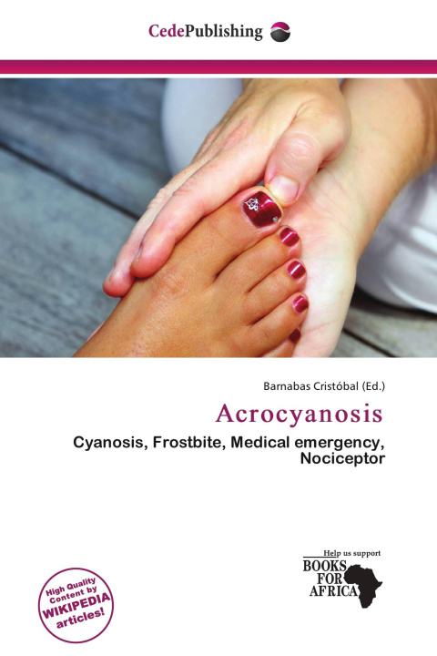 Libro Acrocyanosis 