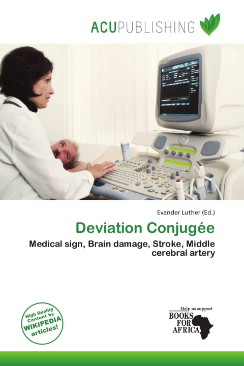 Carte Deviation Conjugée 