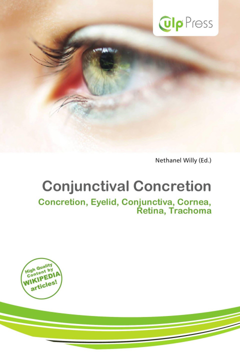 Книга Conjunctival Concretion 