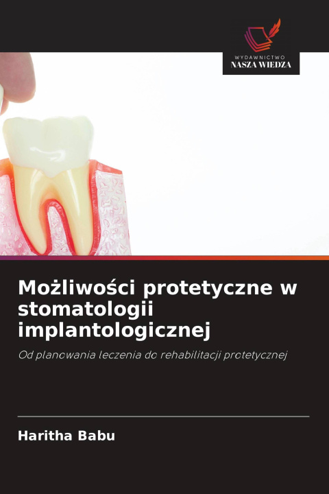 Buch Mo¿liwo¿ci protetyczne w stomatologii implantologicznej 