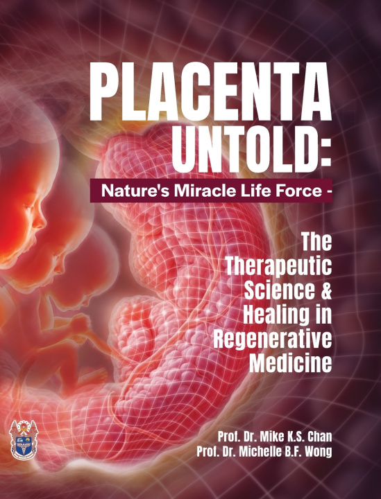 Könyv Placenta Untold Mike K.S. Chan