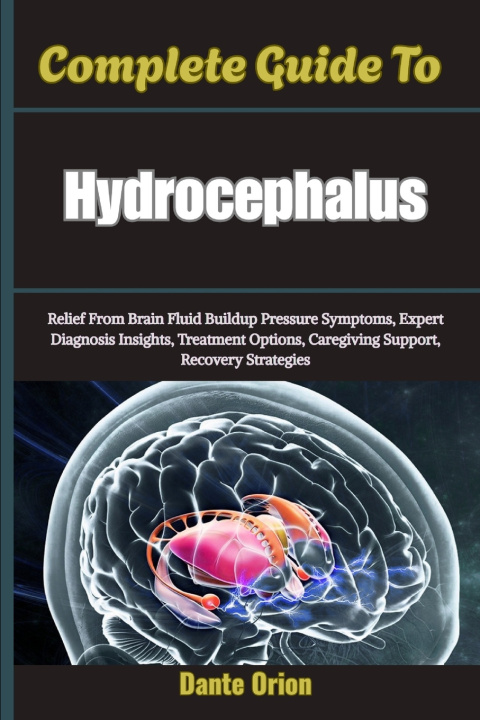 Könyv Complete Guide To Hydrocephalus Dante Orion