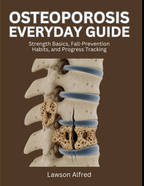 Könyv Osteoporosis Everyday Guide Lawson Alfred