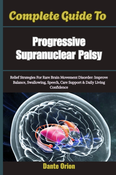 Könyv Complete Guide To Progressive Supranuclear Palsy Dante Orion