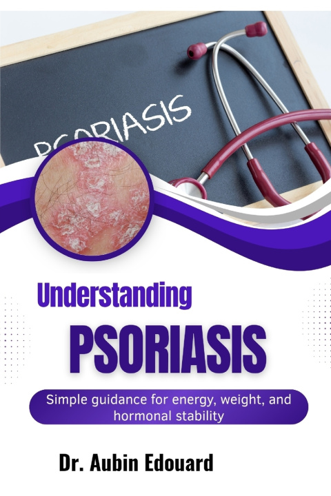 Könyv Understanding Psoriasis Dr. Aubin Edouard