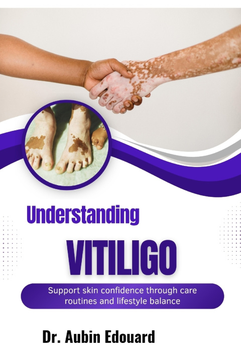 Könyv Understanding Vitiligo Dr. Aubin Edouard