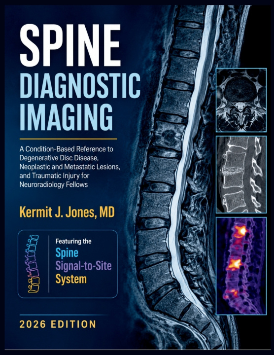 Könyv Spine Diagnostic Imaging 2026 Kermit J. Jones MD