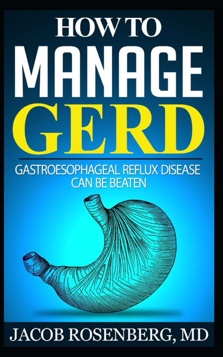 Könyv How to manage GERD Jacob Rosenberg