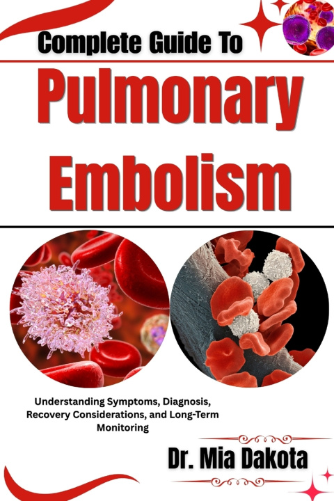 Könyv Complete Guide To Pulmonary Embolism Dr. Mia Dakota
