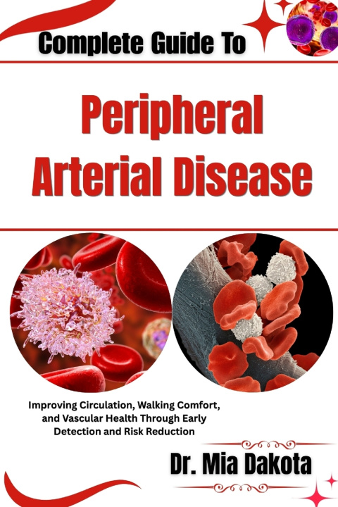 Könyv Complete Guide To Peripheral Arterial Disease Dr. Mia Dakota