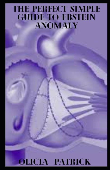 Buch The Perfect Simple Guide To Ebstein Anomaly Olicia Patrick