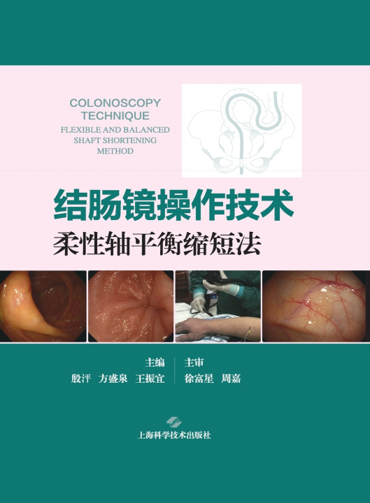 Kniha Colonoscopy Operating Technique 殷泙 方盛泉 王振宜 主编，徐