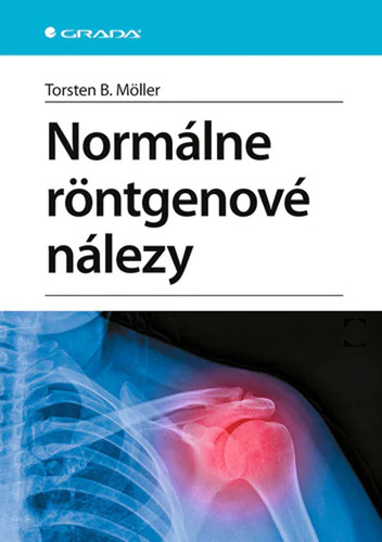 Buch Normálne röntgenové nálezy Torsten B. Moller