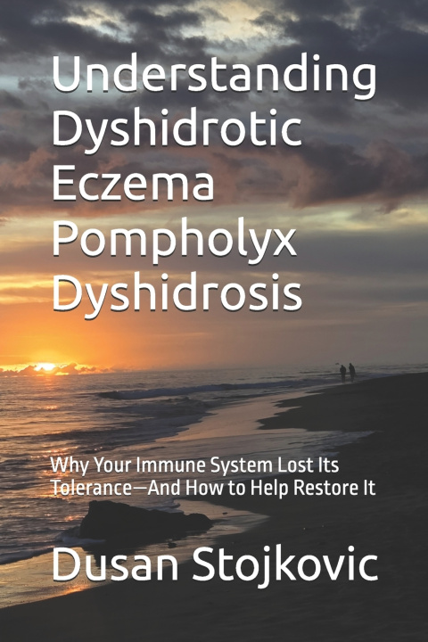 Buch Understanding Dyshidrotic Eczema Pompholyx Dyshidrosis Dusan Stojkovic