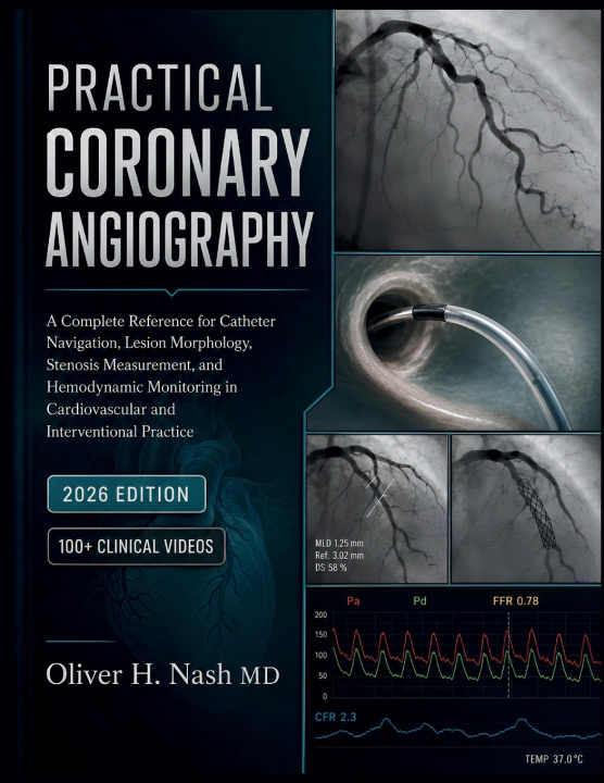Kniha PRACTICAL CORONARY ANGIOGRAPHY Oliver H. Nash MD
