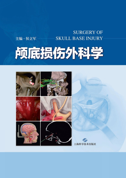 Knjiga Skull Base Trauma Surgery/颅底损伤外科学 侯立军 主编