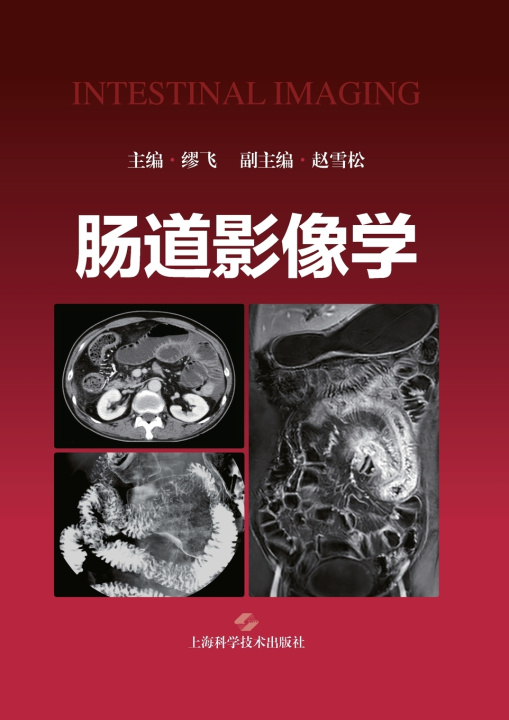 Kniha Intestinal Imaging/肠道影像学 缪飞 主编